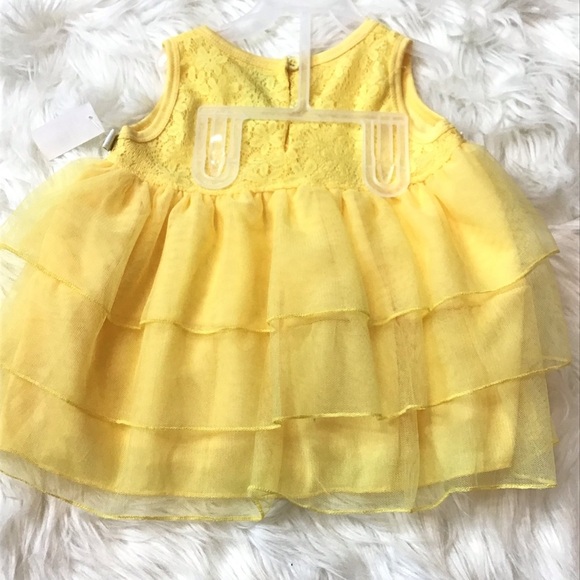 Duck Duck Goose 2Pc Baby Girl Yellow Tunic & Shorts Set Outfit Size 24 Months - Picture 5 of 9